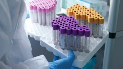 Шымкентте өткен тәулікте 502 адам коронавирус жұқтырған