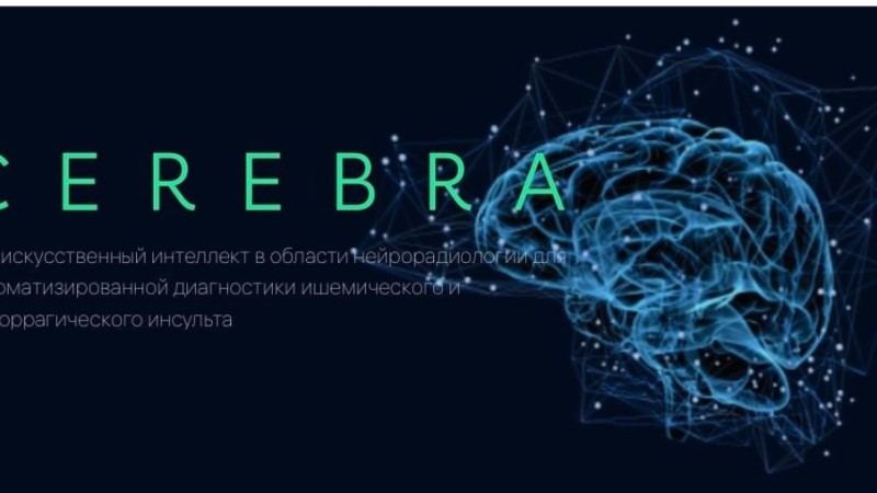 Ми инсультін анықтайтын жасанды интеллект жүйесі іске қосылды