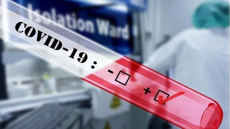 Бір тәулікте Covid-19-дың 220 жағдайы тіркелді